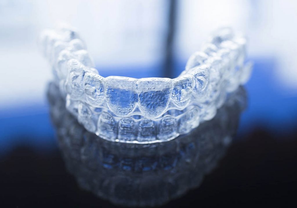 Invisalign, eine unsichtbare Zahnspange, auf blauem Hintergrund.