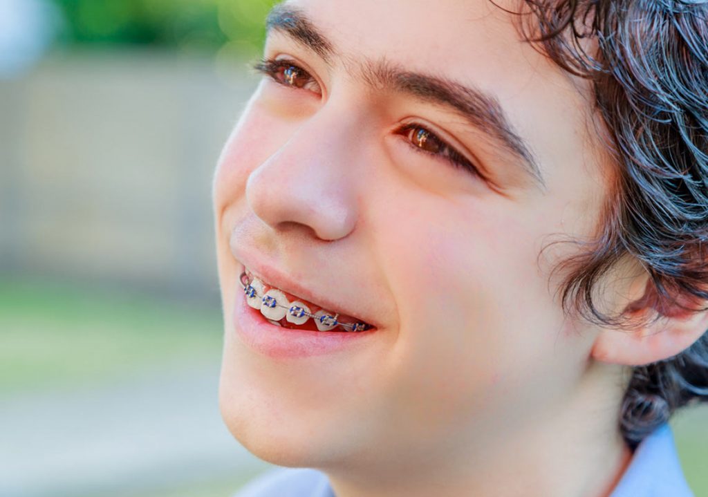 Bild eines Jungen mit Metallbrackets.