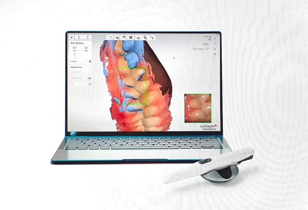 Intraoralscanner 2 Kieferorthopäde Konstanz Dr. Dr. Draheim